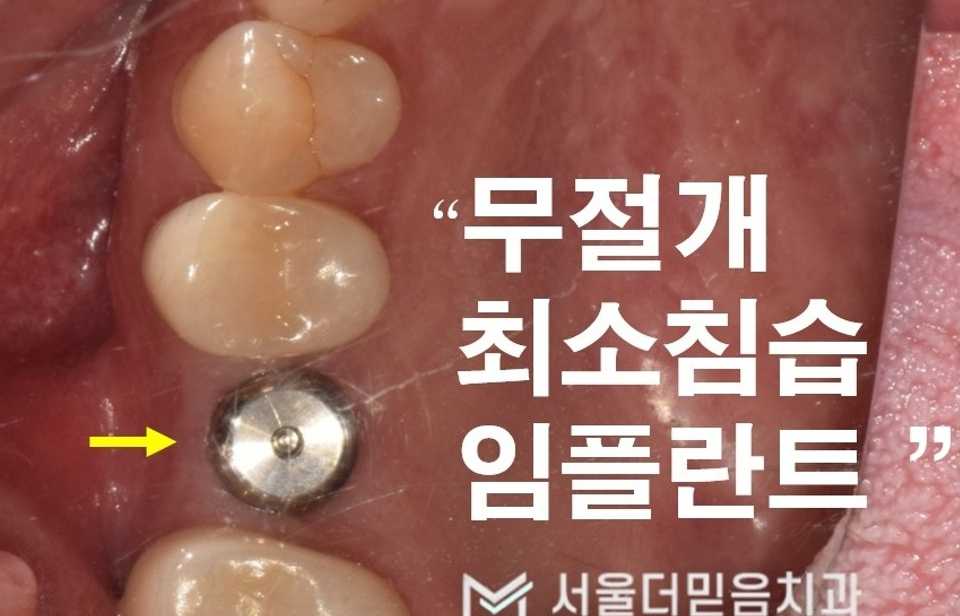 서울더믿음치과