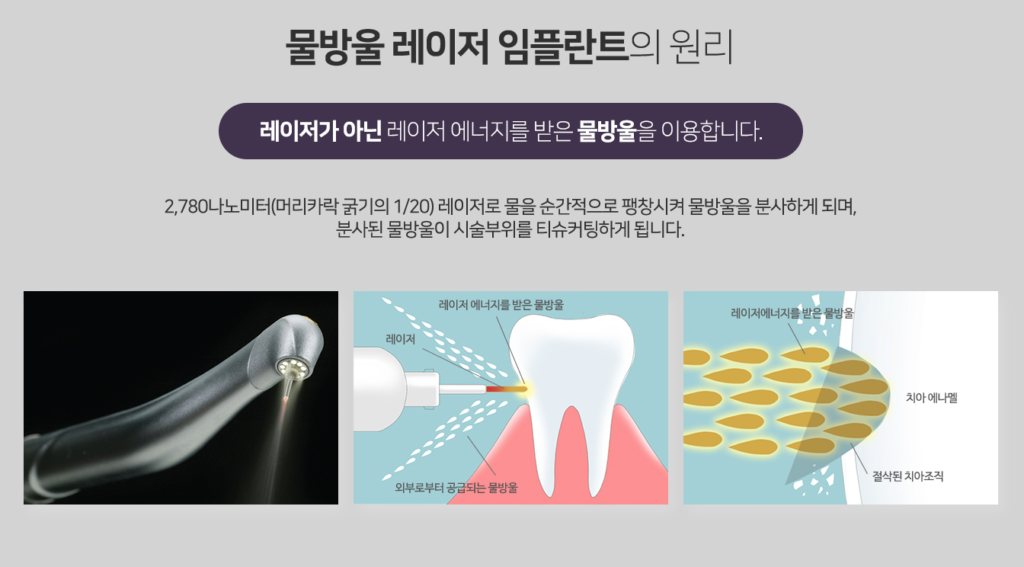 판교-밸런스치과